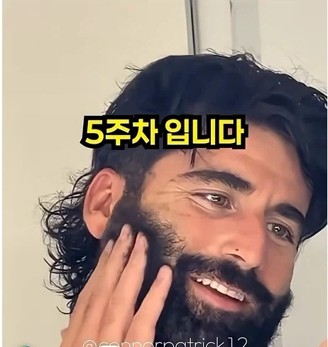 남자들이 은근 부러워 하는 털.jpg - 이미지 11