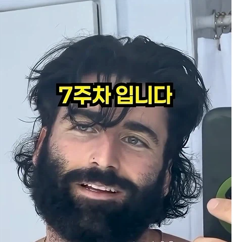 남자들이 은근 부러워 하는 털.jpg - 이미지 14
