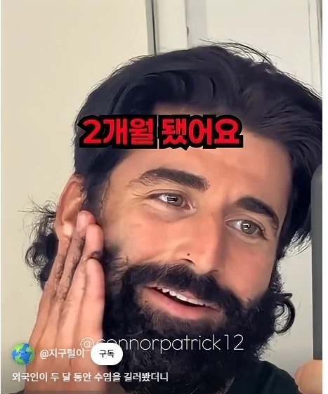 남자들이 은근 부러워 하는 털.jpg - 이미지 15