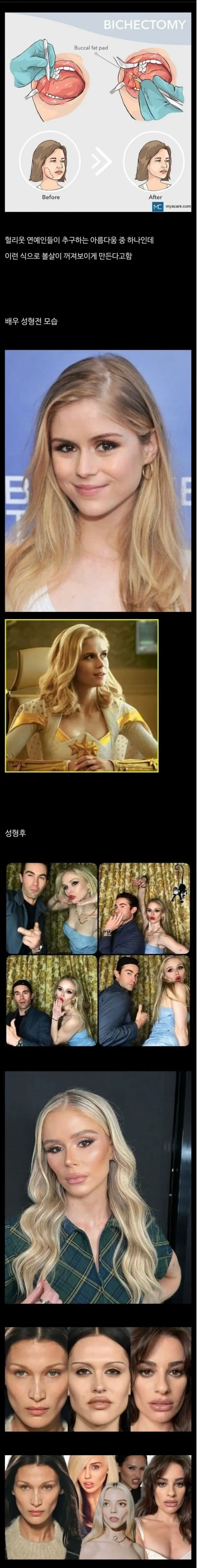 미국에서 동양인 캐 그릴 때 광대 강조하는건 동양인 스테레오 타입이라기보다는
