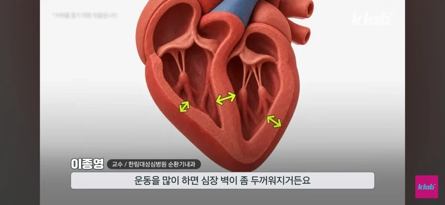 러닝하다 쓰러지는 2030 - 이미지 19