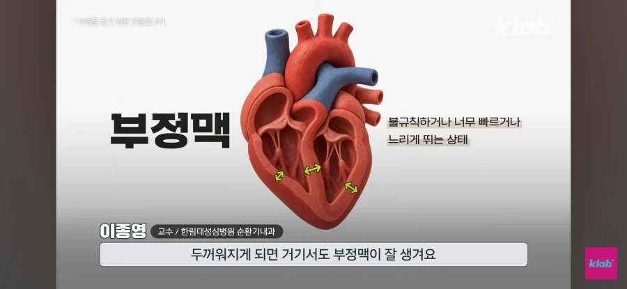 러닝하다 쓰러지는 2030 - 이미지 20