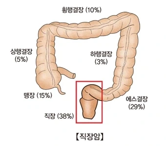 회사 엔지니어가 말이랑 야스하다 죽은 지 몇 년? - 이미지 4