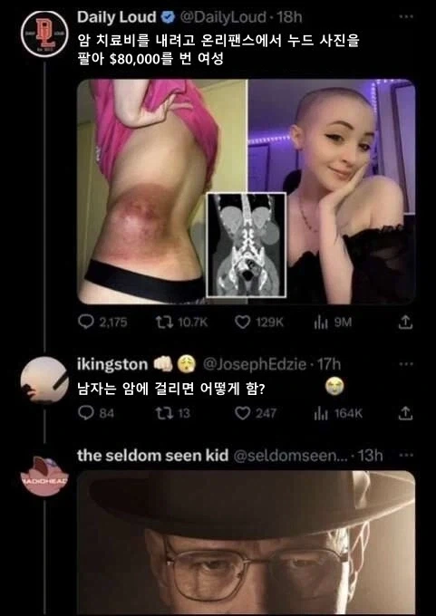 온리팬스로 암 치료비 번 여성