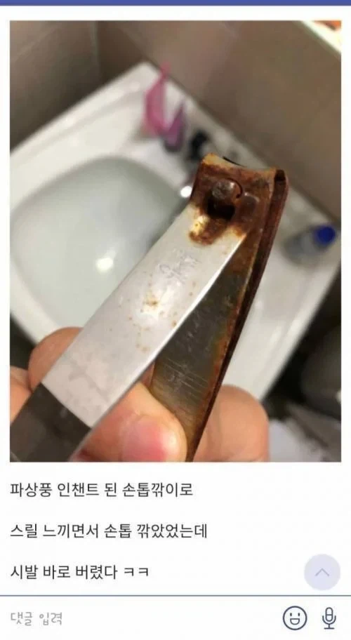 녹슨 손톱깎이로 발톱깎다가 ㅈ될뻔함.jpg - 이미지 2