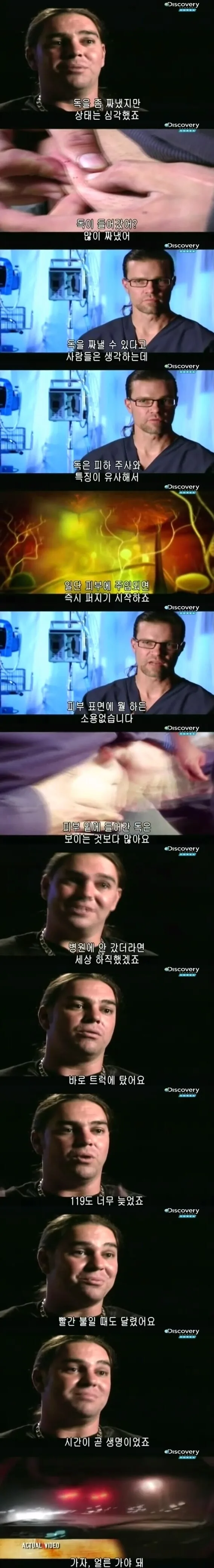 [극혐] 코브라한테 물려서 배에 구멍이 뚫린 청년.jpg - 이미지 4