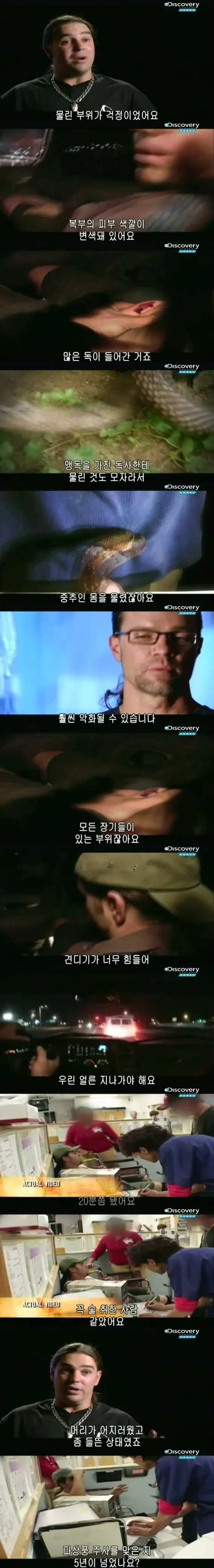 [극혐] 코브라한테 물려서 배에 구멍이 뚫린 청년.jpg - 이미지 6