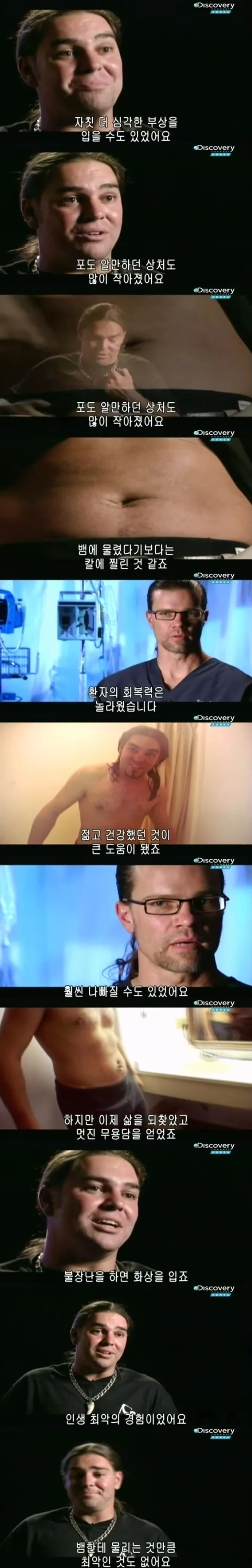 [극혐] 코브라한테 물려서 배에 구멍이 뚫린 청년.jpg - 이미지 11