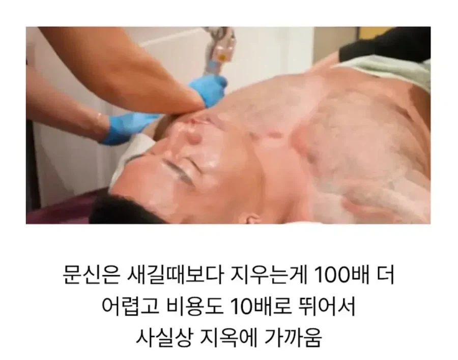 딸이 태어나고 문신을 다 지운 아빠.jpg - 이미지 4