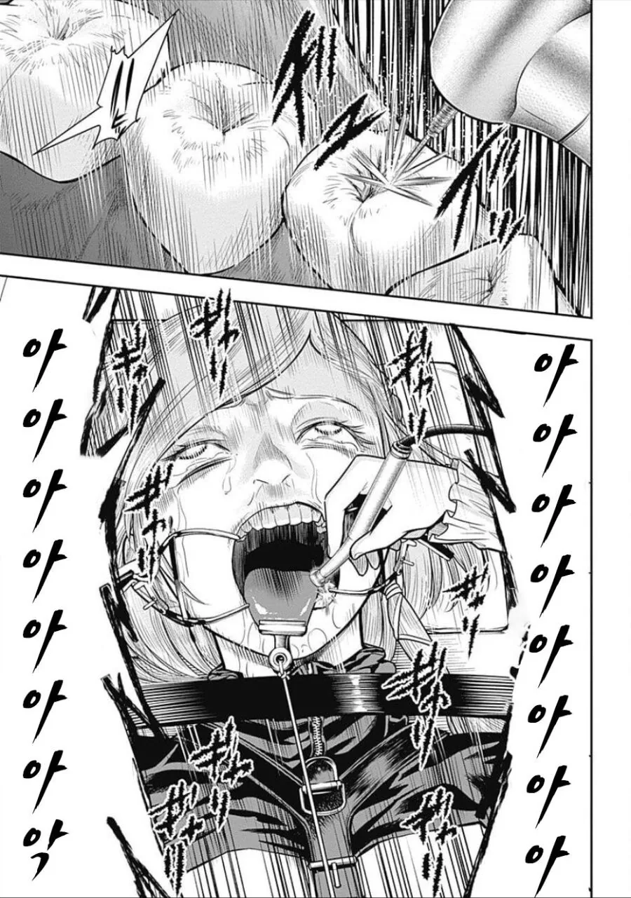 약혐) 치아 신경 고문하는 만화.manga