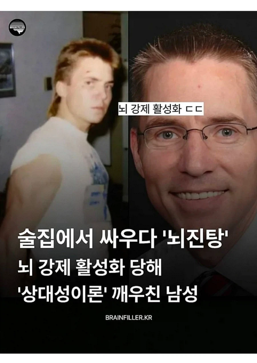 뇌진탕으로 천재가 된 남성 ㄷㄷㄷ;,