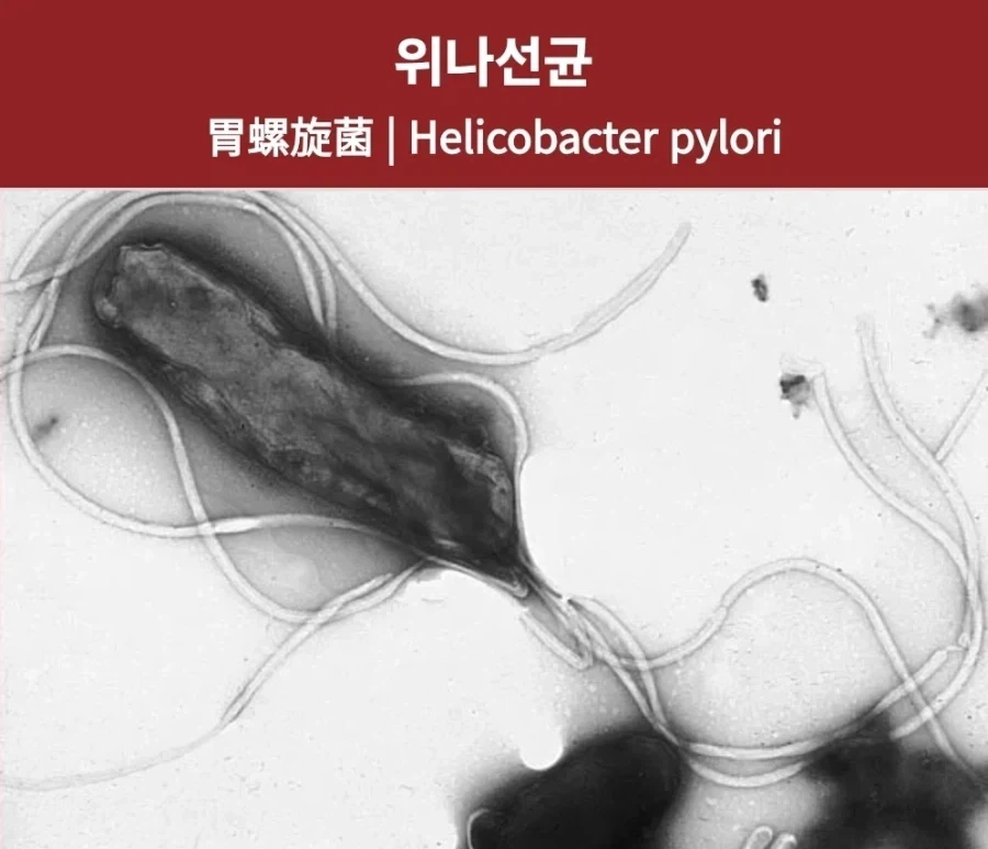 이 로리를 보고 박고 싶다는 충동이 든다면 의사와 상의하셔야 합니다.