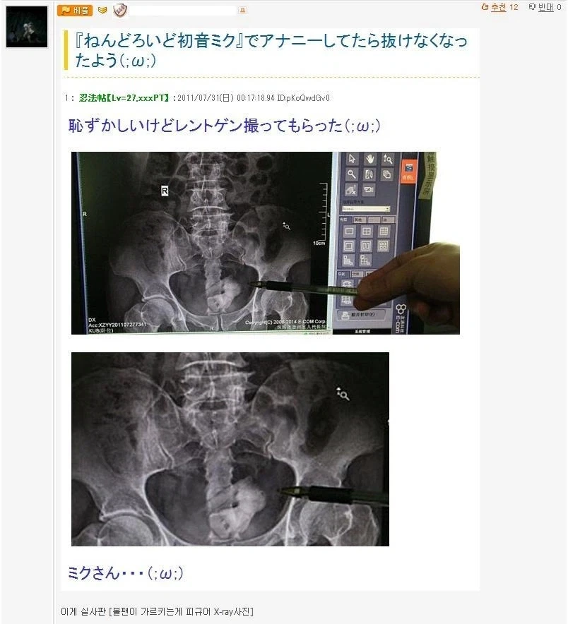 애널자위 하다가 미쿠를 가둬버린 남자