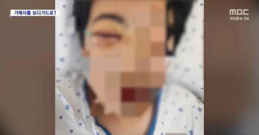 학교폭력으로 중상.. 한 달 넘게 등교 못 해.jpg
