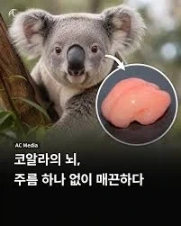 뇌에 주름이 하나도 없으면 생기는 일 jpg