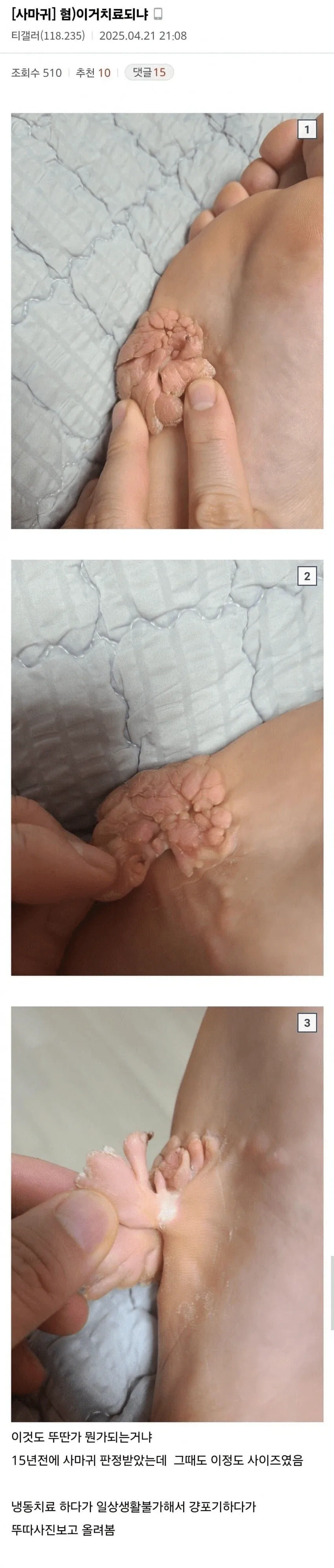 혐) 사람이 물으면 대답을해 이 괴물새꺄